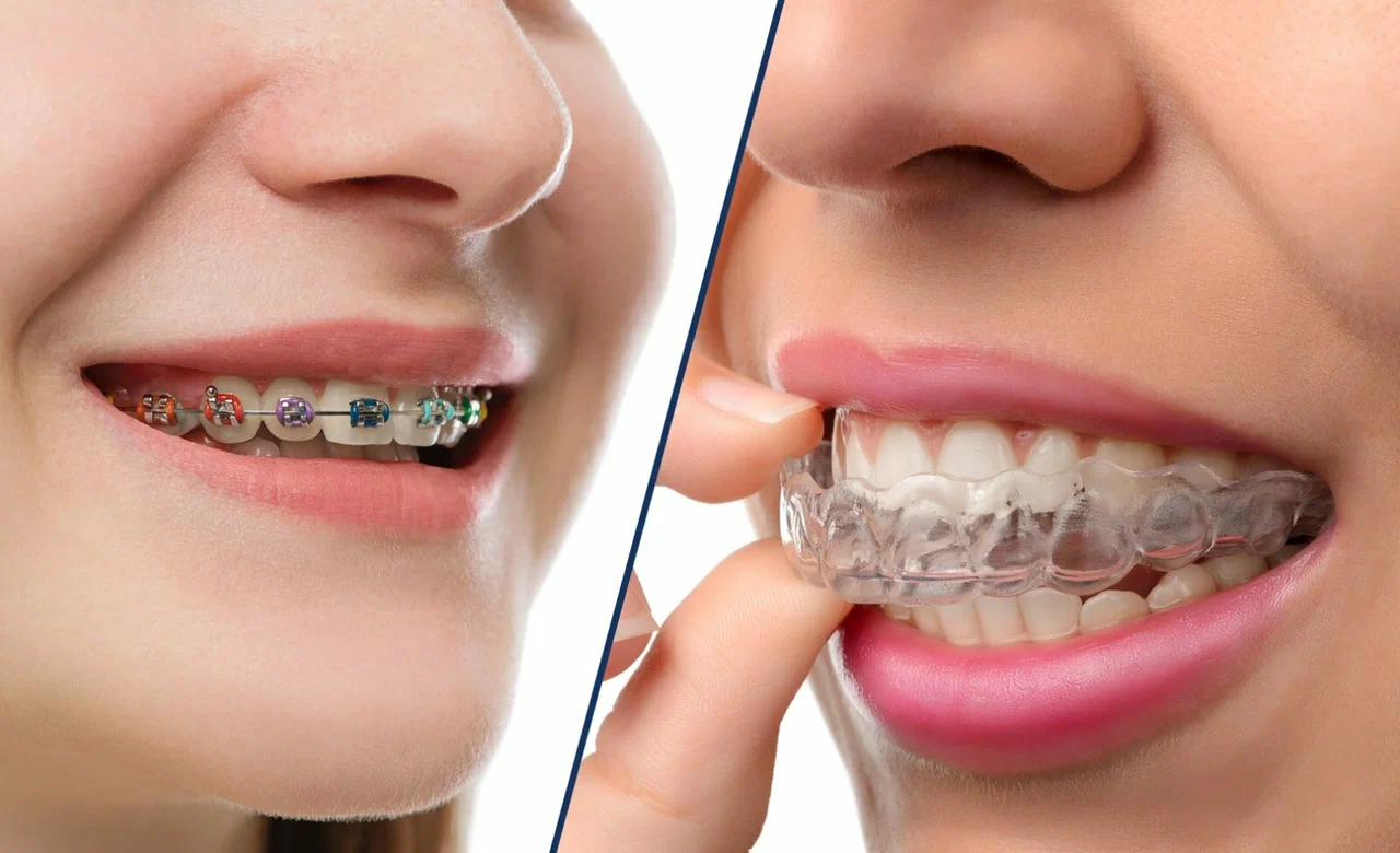 best orthodontist in andheri