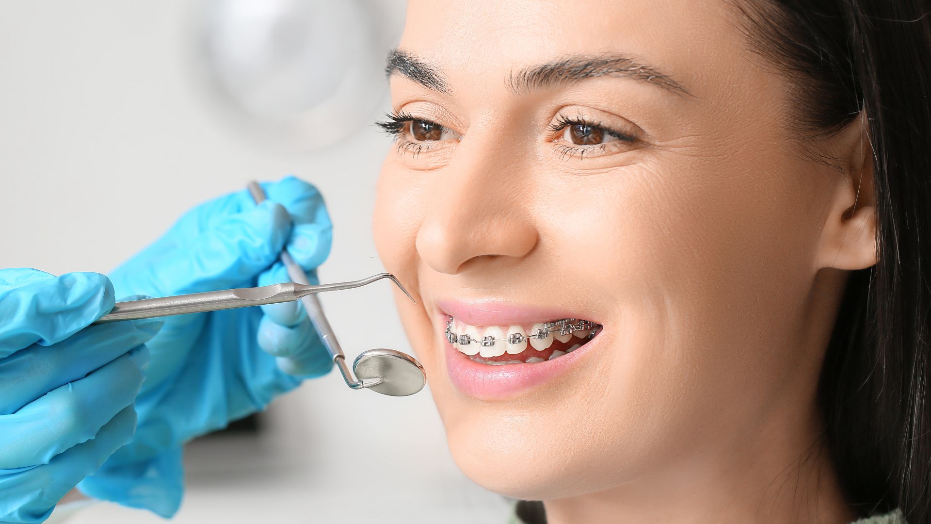 Braces Basics: Understanding the Treatment