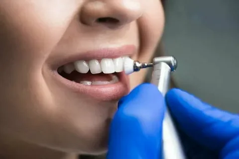 affordable teeth cleaning in nizamabad