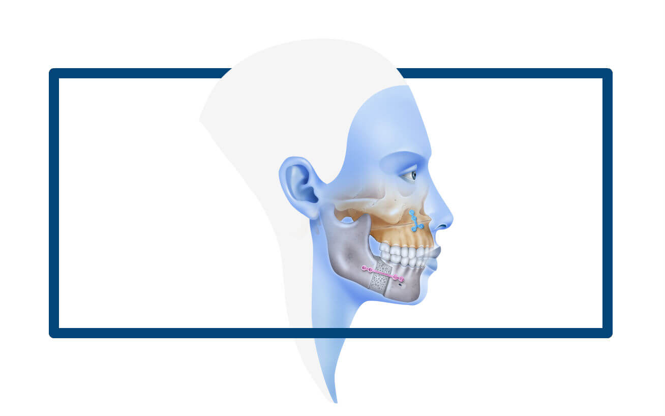 oral maxillofacial surgery in raghavendra colony