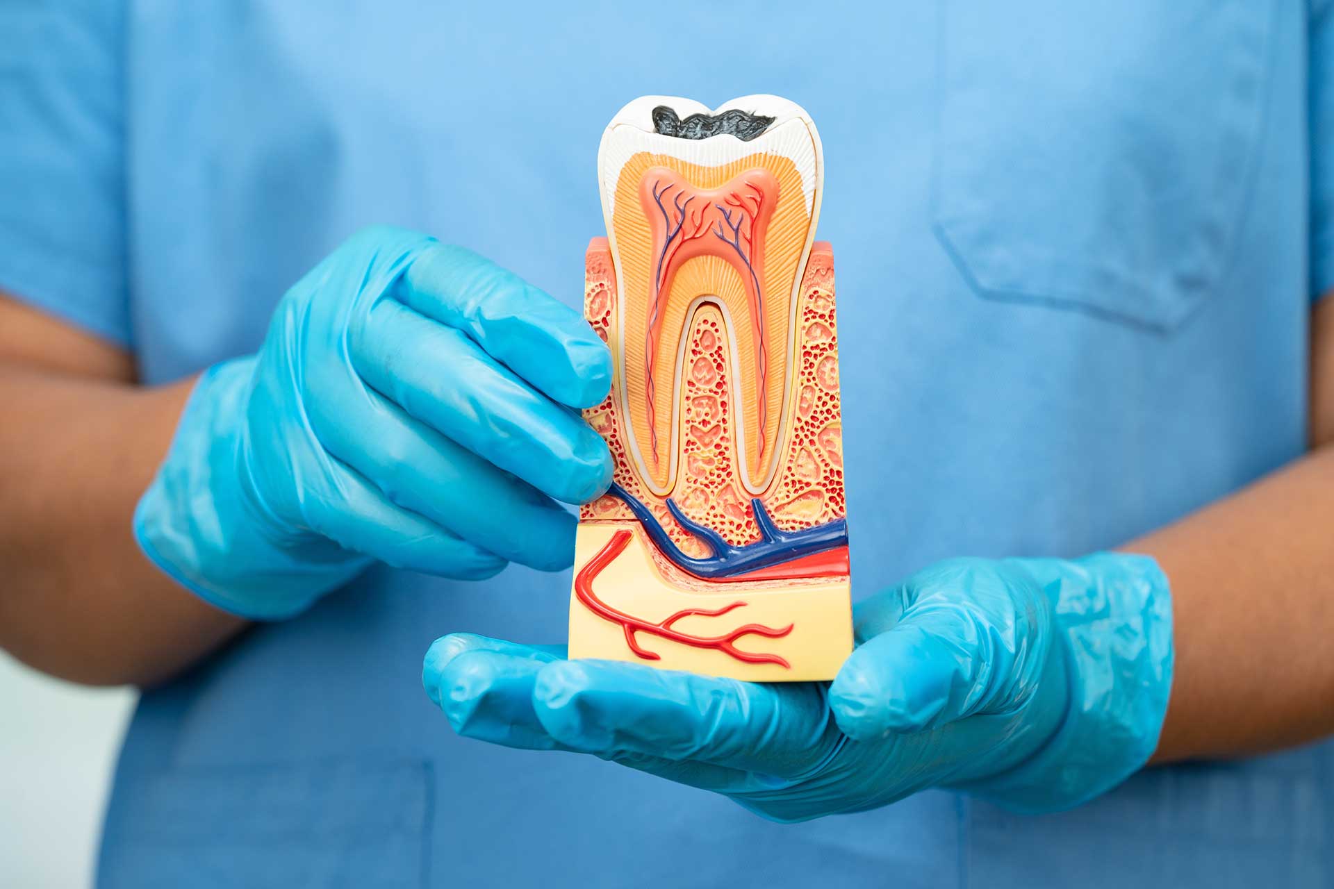 Root Canal Treatment: What It Is, When You Need It, and What to Expect