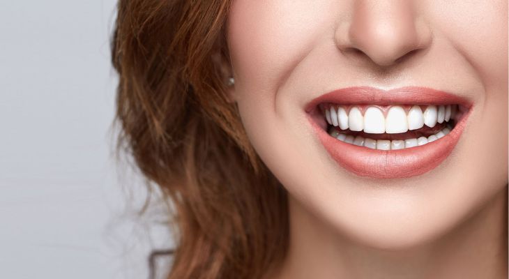 Smile Makeovers in Delhi