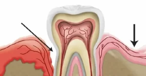 teeth-structure