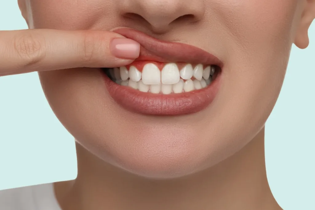 affordable bleeding gum treatment in hubli