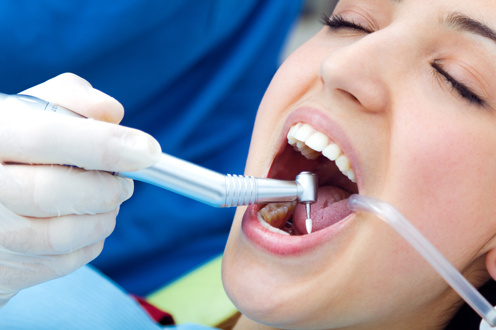 dental filling treatment