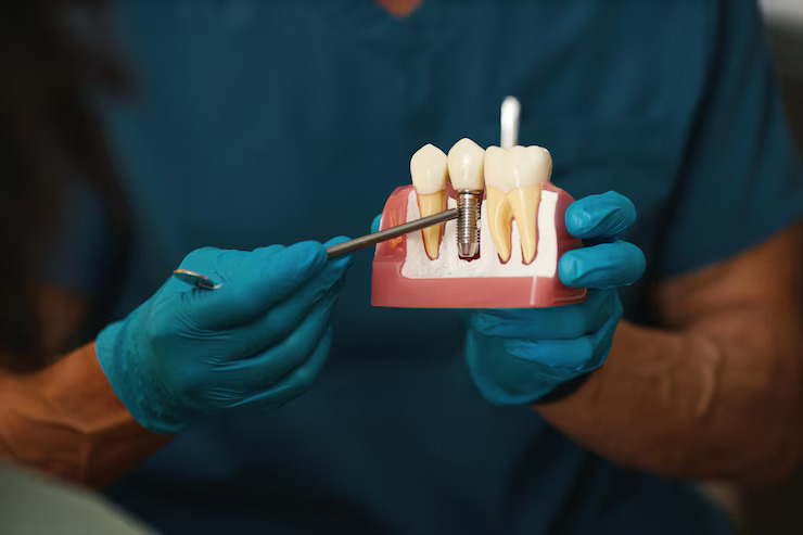 best dental implant specialist in navi mumbai