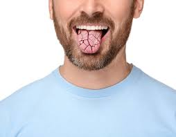 How to Fix Dry Mouth in Winter