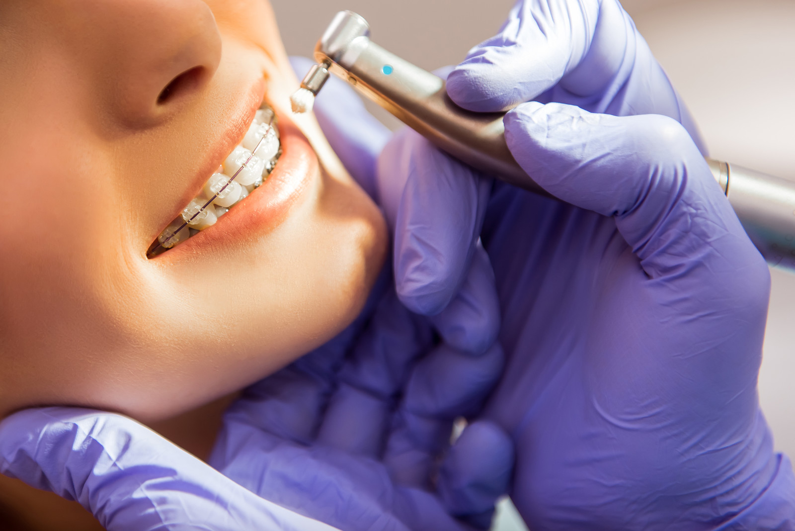 braces treatment in jamshedpur