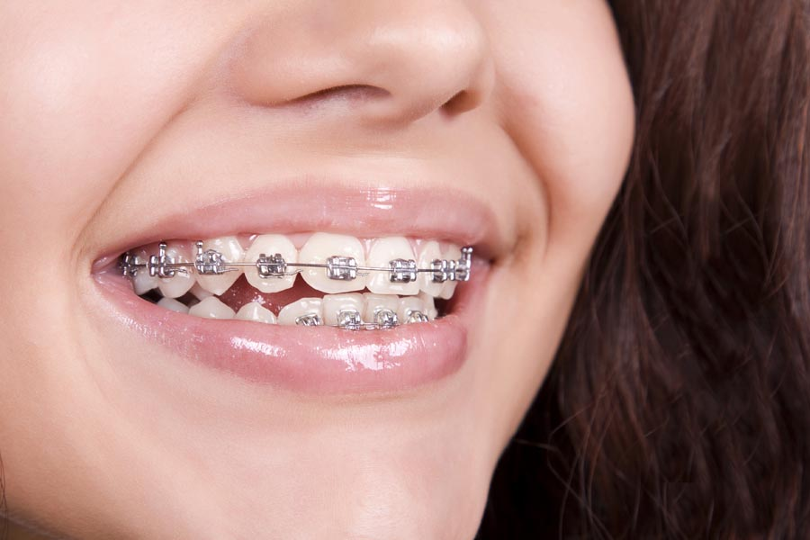 orthodontic treatment in nagpur