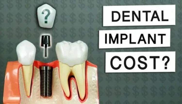 dental implant cost explained: what are you really paying for