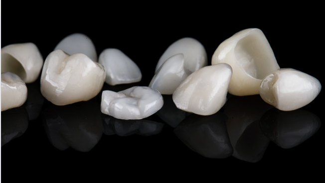 dental crown in prashant vihar delhi