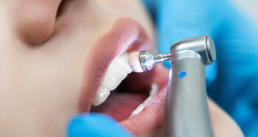 teeth cleaning cost in navi mumbai