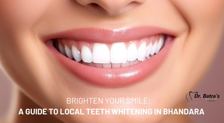 teeth Whitening in Bhandara