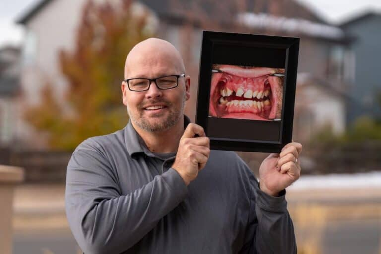 dental veneers cost in andheri west