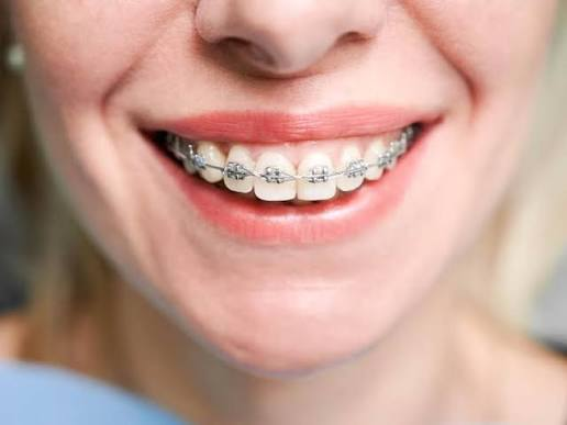 orthodontic treatment in nagpur